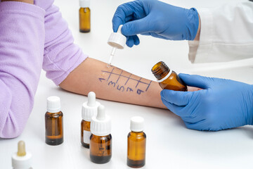 ALLERGY SKIN TEST ON THE ARM. HEALTH CARE CONCEPT. CLINICAL DIAGNOSIS. HEALTH INSURANCE.