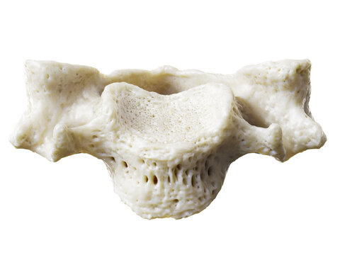 3d rendered illustration of a cervical vertebrae