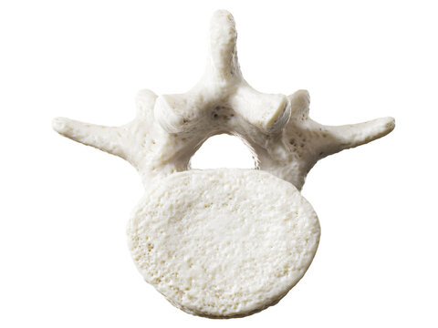 3d rendered illustration of a lumbar vertebrae