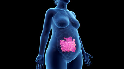 3d rendered illustration of an obese womans small intestine