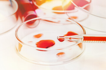 Corona Virus in Lab.Petri dish and test tubes with blood in the laboratory. Blood coronavirus test.Virus vaccine development.Medical laboratory. The concept of laboratory research. Close-up.COVID-19.