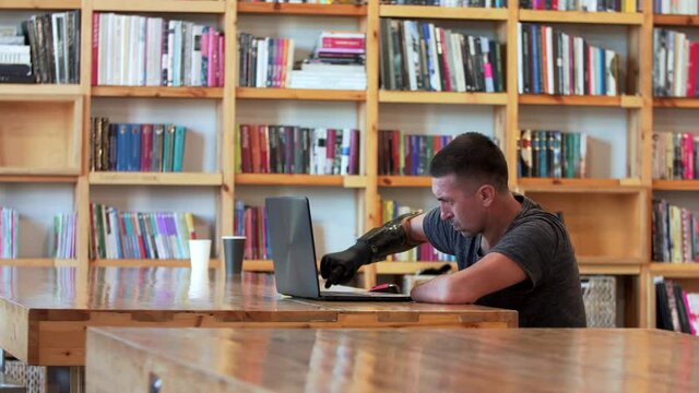A caucasian man with amputated two stump hands is typing on the laptop using his new modern bionic prothesis in the library. A man living with a disability is using the laptop in the library