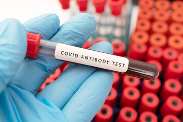 Hand holding a glass of test tube with patient's blood for testing covid antibody