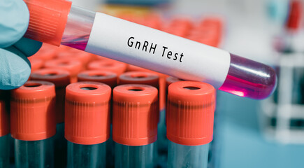 Hypothalamus Gonadotropin releasing hormone  GnRH Test Regulates LH/FSH production in the pituitary gland
