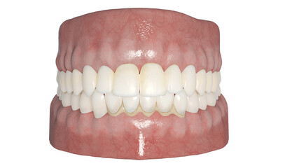 3d rendered illustration of a dental calculus