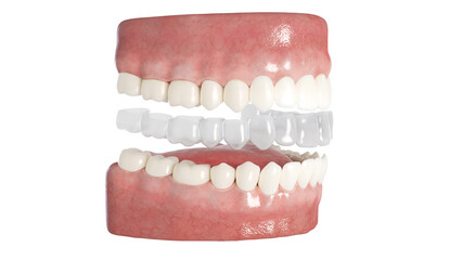 3d rendered illustration of a clear dental aligner