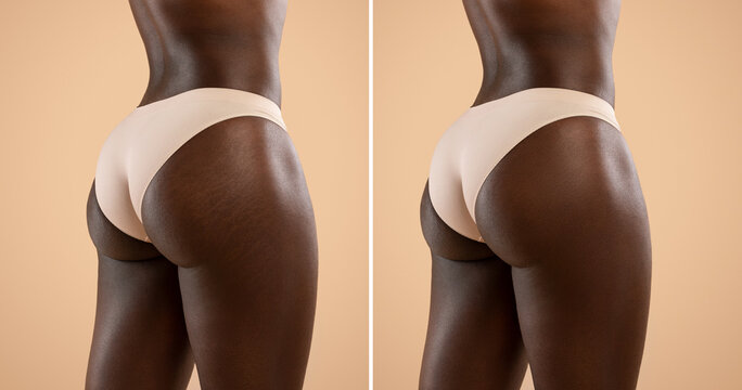 Before and after collage, black woman buttocks