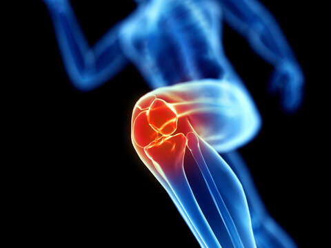 3d rendered illustration of a joggers knee