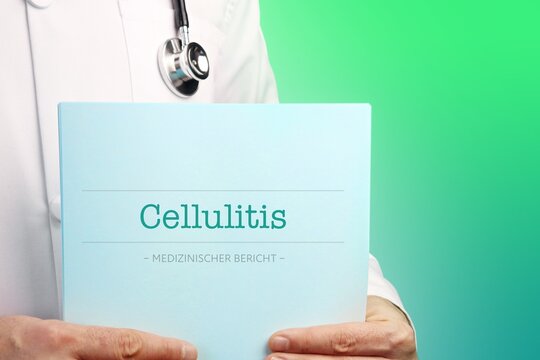 Cellulitis. Arzt mit Stethoskop h&auml;lt medizinischen Bericht in den H&auml;nden. Text auf Dokument