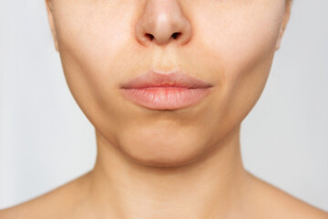 Cropped shot of a young caucasian woman's lower part of the face with clear highlighted cheekbones. Plastic surgery buccal fat removal. Result of cosmetic surgery