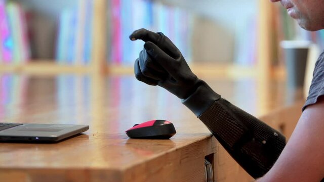 Close view of a black modern bionic prothesis. A caucasian man living with a disability with amputated two stump hands is operating and typing on the laptop using his robotic hand