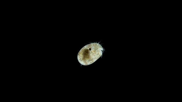 Ostracoda under a microscope, Cypridinidae family, Myodocopida Order. Sample found in Red sea
