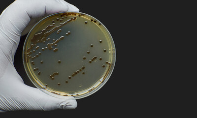 Black bacteria colonies on Selective media Agar Plates in petri dish 