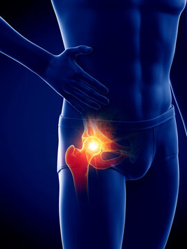 3d rendered medically accurate illustration of a man having a painful hip joint