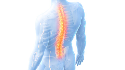 3d rendered illustration of a painful back