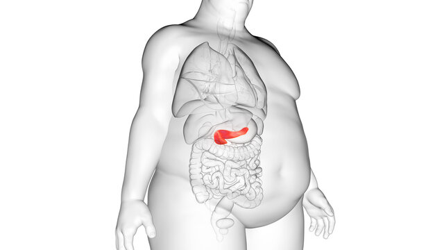 3d rendered illustration of an obese mans pancreas