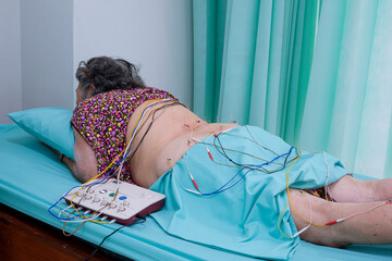 An Asian senior woman lying in bed while undergoing electrical acupuncture procedure for back and hip pain in hospital room - obrazy, fototapety, plakaty