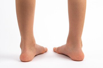 children's feet on a white background rear view, the concept of prevention of children's flat feet, valgus of the foot