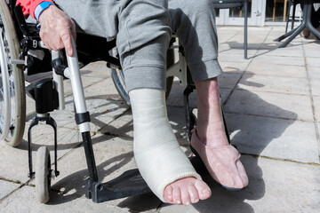 Obraz premium Cheville plâtrée sur une personne âgée. Fracture de la malléole. Plan sur les jambes, sur un fauteuil roulant.