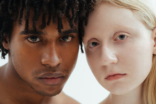 Male and woman with contrast skin