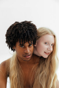 studio shot of black guy and albino woman