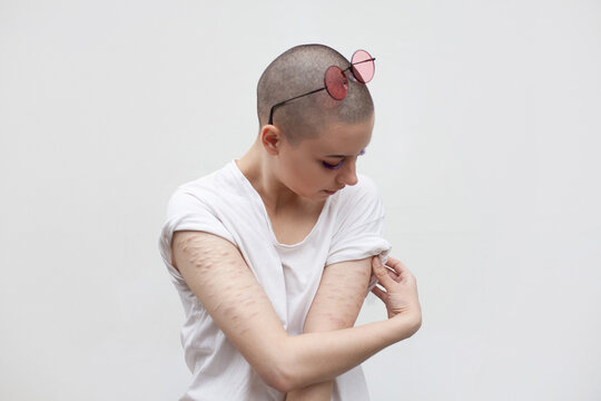 Bald woman in white t-shirt