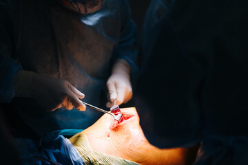 Surgeons during operation