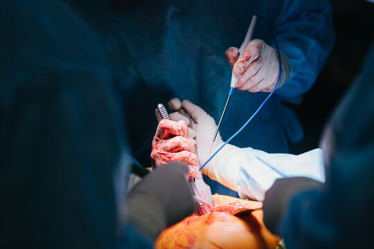 Surgeons during operation