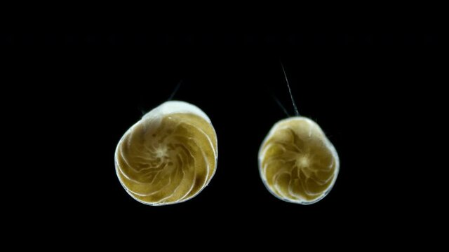 Foraminifera under a microscope, class Rotaliata, possibly order Rotaliida. Protista have a mineral shell. Shows movement of pseudopodia with which she captures food