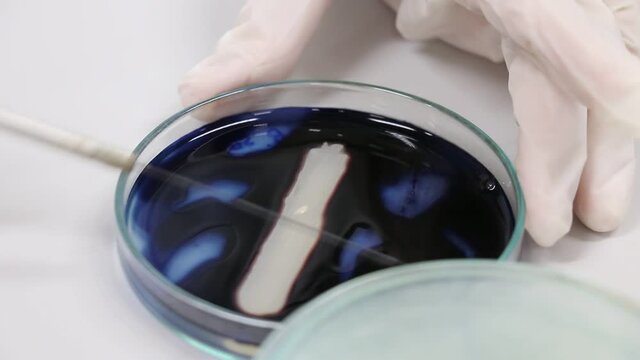 Testing infection microbiology with iodine in laboratory.
