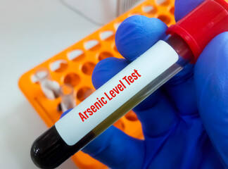 Fototapeta premium Blood sample for Arsenic Level test. Arsenic is a heavy metal element. High levels of arsenic may have arsenic poisoning