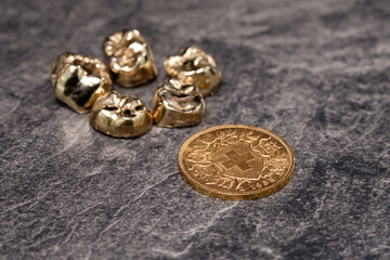 Eine Vreneli Goldmünze und Goldzähne / Schweiz 20 FR - Schweizer Goldvreneli (liegend Wappenseite)