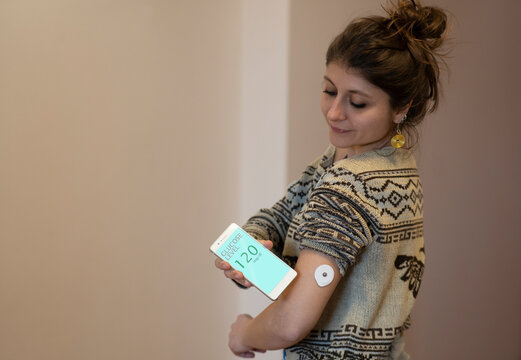 Caucasian Diabetics Patient Checking Glucose Level With A Remote Sensor And Smartphone. Continuous Monitoring Glucose Levels Without Blood Using Digital Glucose Meter.