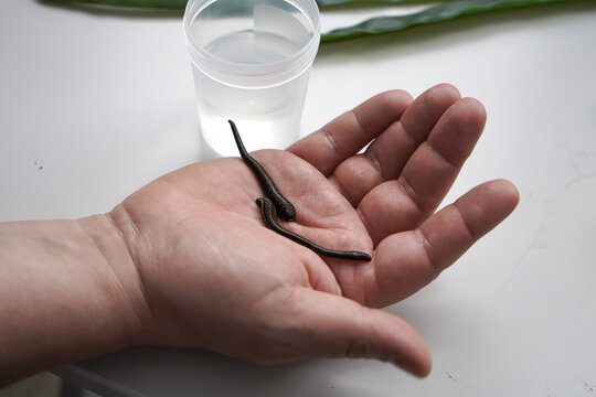 A hand holds a leech. Alternative treatment