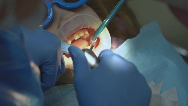 little girl with oral dilator at dentist's appointment. polishing of teeth