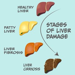 progression of liver damage