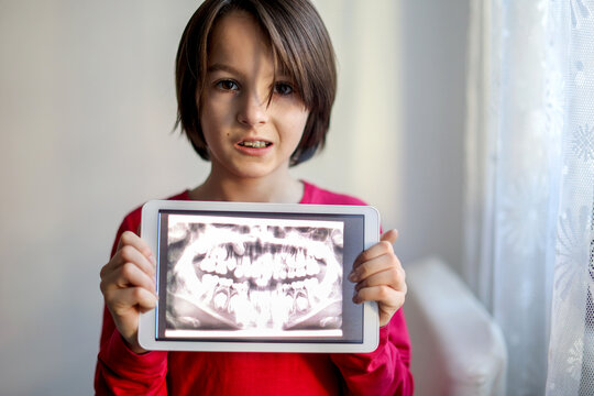 Child, wearing braces, preteen boy, holding tablet with a picture of his x-ray teeth from the dentistof him