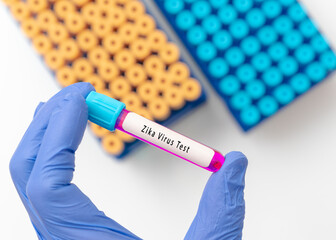 Obraz premium Zika virus test result with blood sample in test tube on doctor hand in medical lab