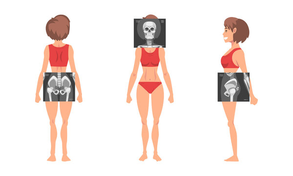 Young Woman Standing in Red Underwear with Her Skeleton X-ray Vector Set