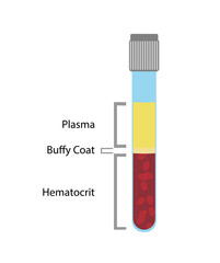 Composition of blood. Blood separted in to Plasma, bufft coat and hematocrit.  