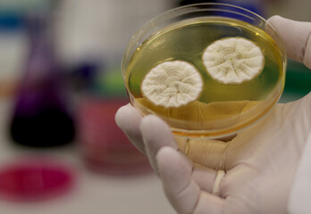 Colonies of microorganisms, fungi, growing in a culture dish in the laboratory