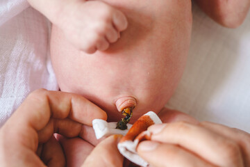 Hands of unknown man father caring for umbilical cord with clamp of newborn baby neonatal care parent clean navel of baby on bed at home cleaning with iodine