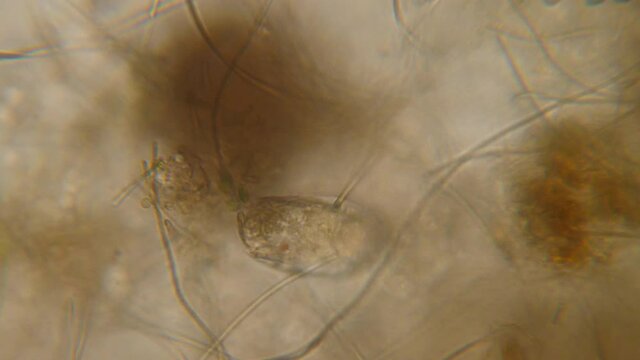 Nematode Worm Under Microscope, Parasites Among Roundworms: Roundworms, Pinworms, Trichinella. Bacteria Parasites and Worms in Drinking Water Under Microscope. Environmental Pollution.