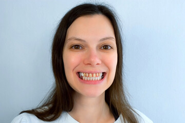 Portrait of woman with yellow bad teeth is smiling and looking at camera. Teeth sharpened by a...