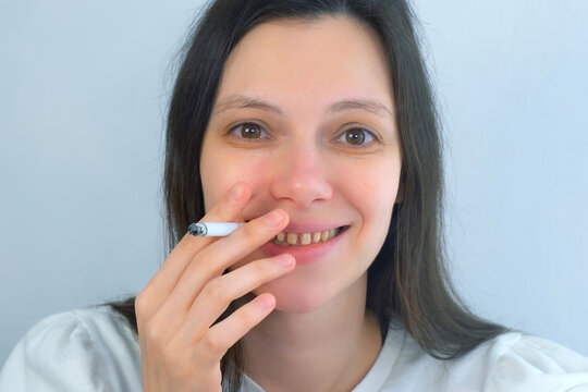 Young woman with yellow bad teeth smoking a cigarrete and smiling looking at camera. Bad habits for dental health, destructive effect of smoking. Ugly smile. Dentistry treatment, prosthetics of teeth.