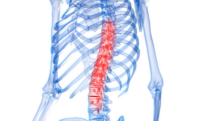 3d rendered illustration of a painful spine