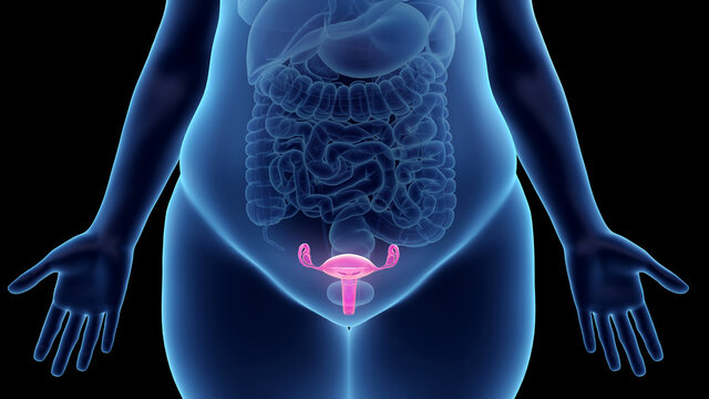 3d rendered illustration of an obese womans uterus