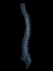 3d rendered illustration of a glass spine