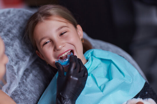 mouth guard - myofunctional trainer to eliminates mouth breathing habit, helps equalize the growing teeth and correct bite. mouthguard in the mouth of a girl close-up. A device for leveling teeth.