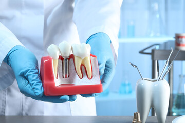 Fototapeta Dentist holding educational model of gum with dental implant between teeth indoors, closeup obraz